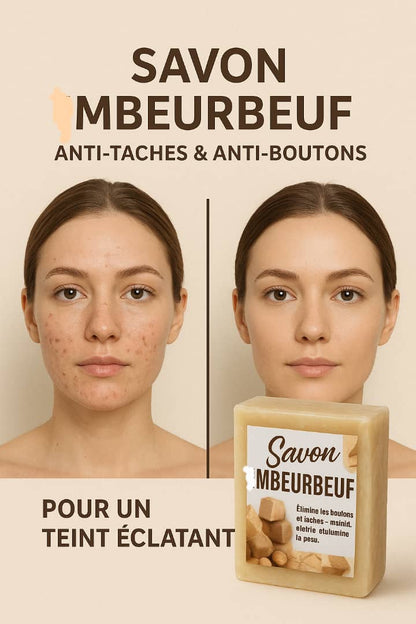 Savon clarifiant et anti-taches MBEURBEUF